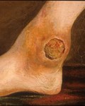 Charles Bell ‘Gunshot wound of the ankle joint,’ oil on canvas